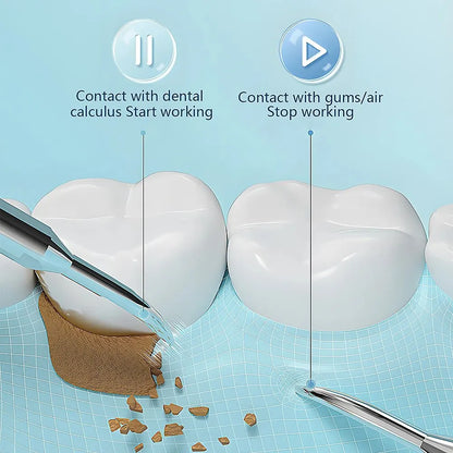 Pro Dental 38 kHz Ultrasonic Tooth Cleaner LED USB
