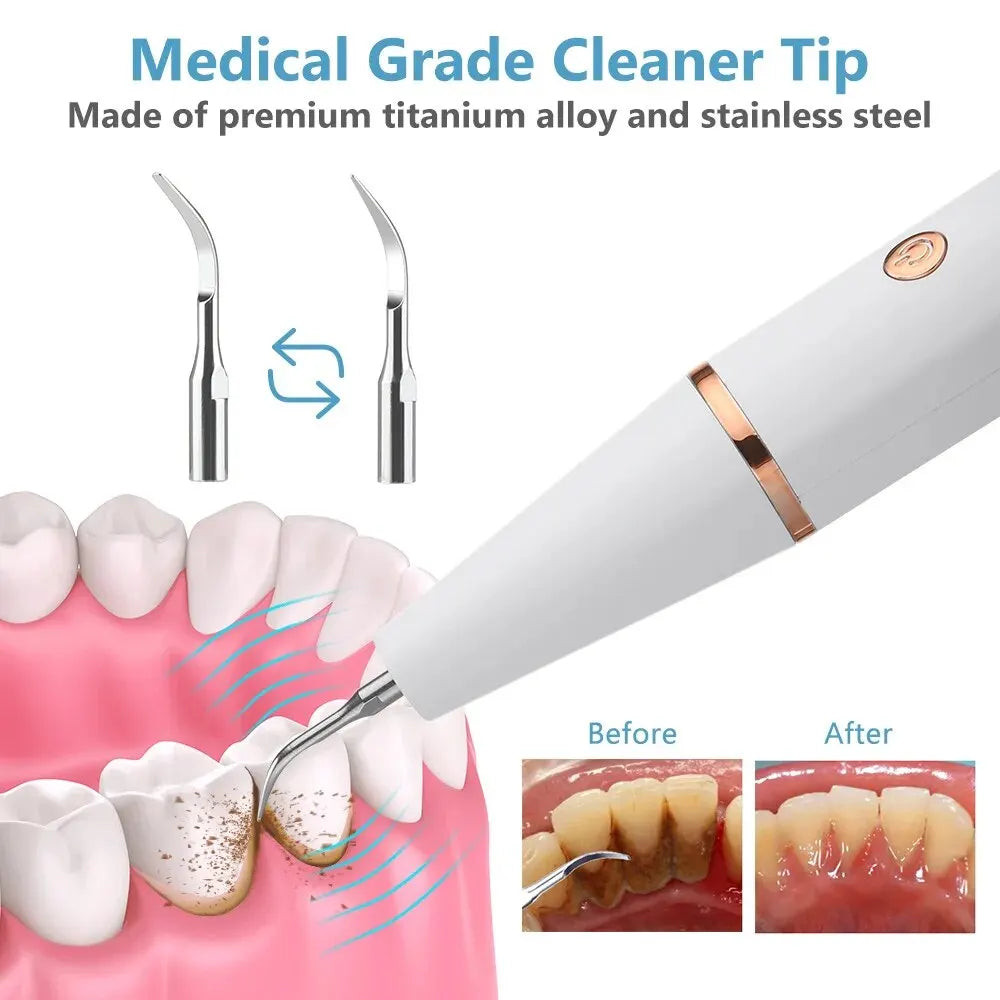 Pro Dental 38 kHz Ultrasonic Tooth Cleaner LED USB