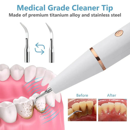 Pro Dental 38 kHz Ultrasonic Tooth Cleaner LED USB