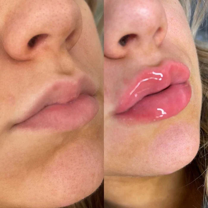 Plumping Lip Serum for Fuller Lips Fast