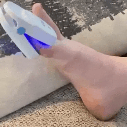 Easy Home Toenail Fungus Removal Laser Device