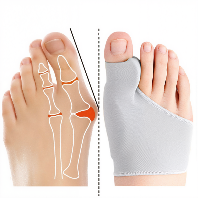 GelComfort | Comfortable Gel Bunion Corrector with Supportive Cushioning 1