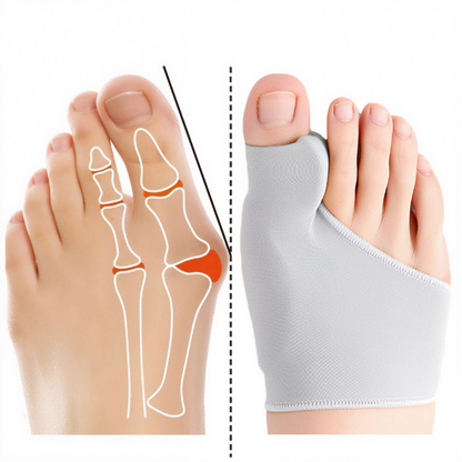 GelComfort | Comfortable Gel Bunion Corrector with Supportive Cushioning 1