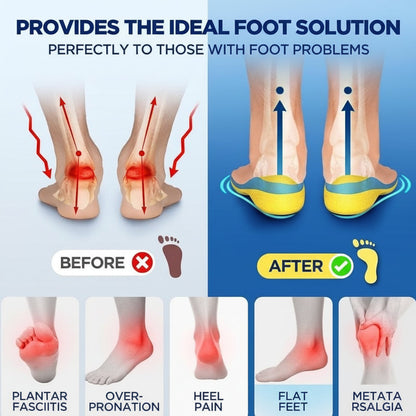 Comfortable Arch Support Insoles for Running