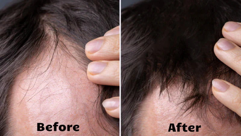Advanced Hair Growth Light Therapy Treatment