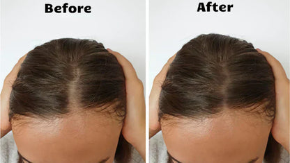 Advanced Hair Growth Light Therapy Treatment