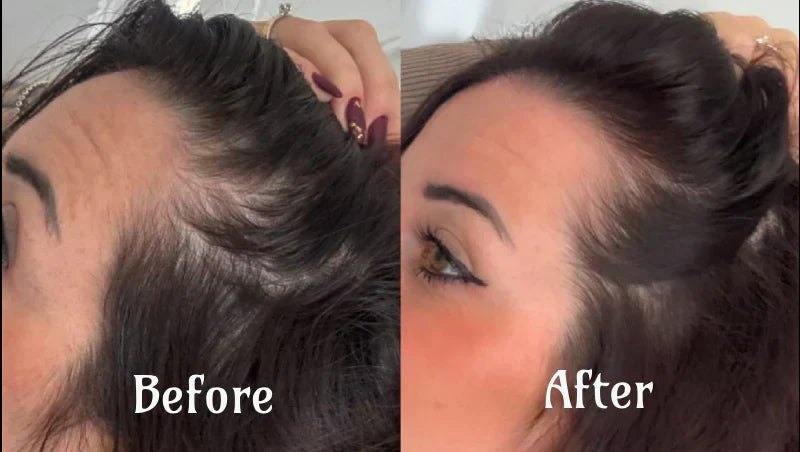 Advanced Hair Growth Light Therapy Treatment
