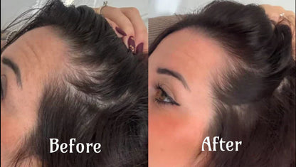 Advanced Hair Growth Light Therapy Treatment