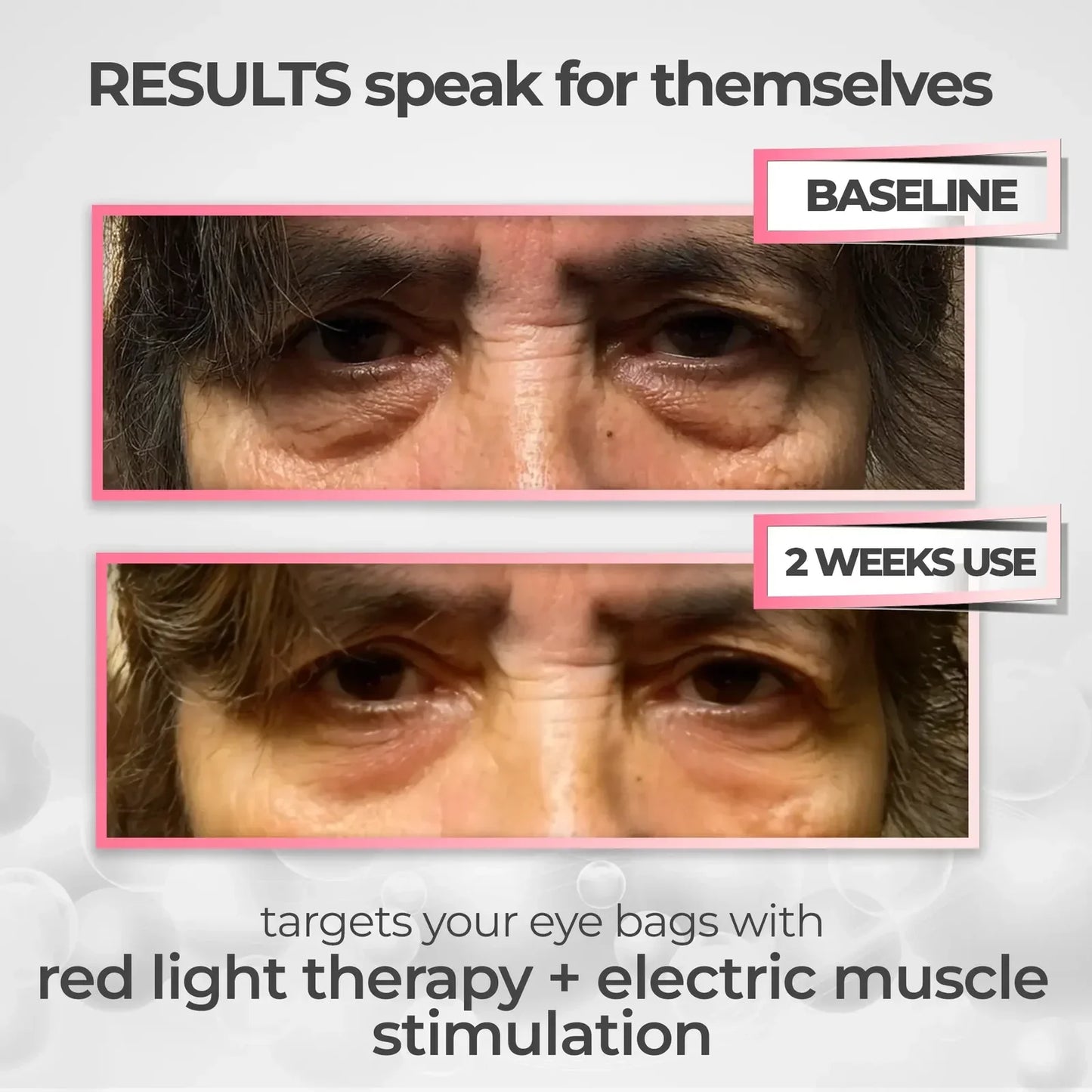 Quick Fix Under Eye Anti Aging Kit