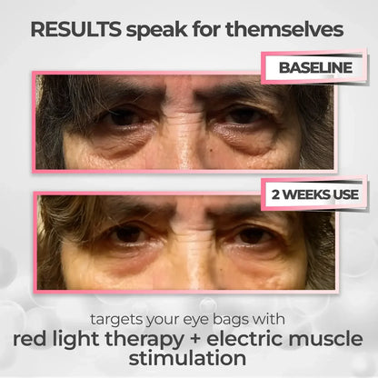 Quick Fix Under Eye Anti Aging Kit