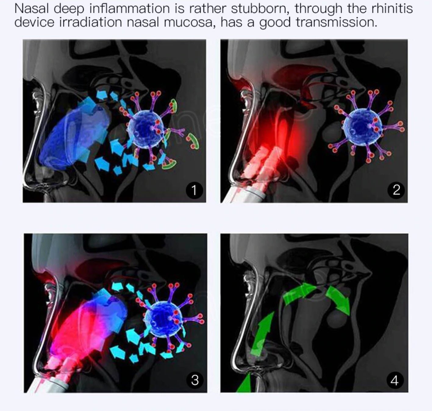 Fast Nasal Pain Relief Device