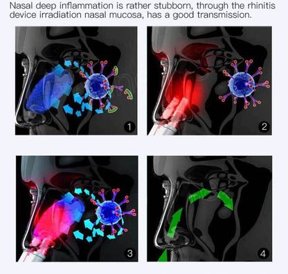 Fast Nasal Pain Relief Device