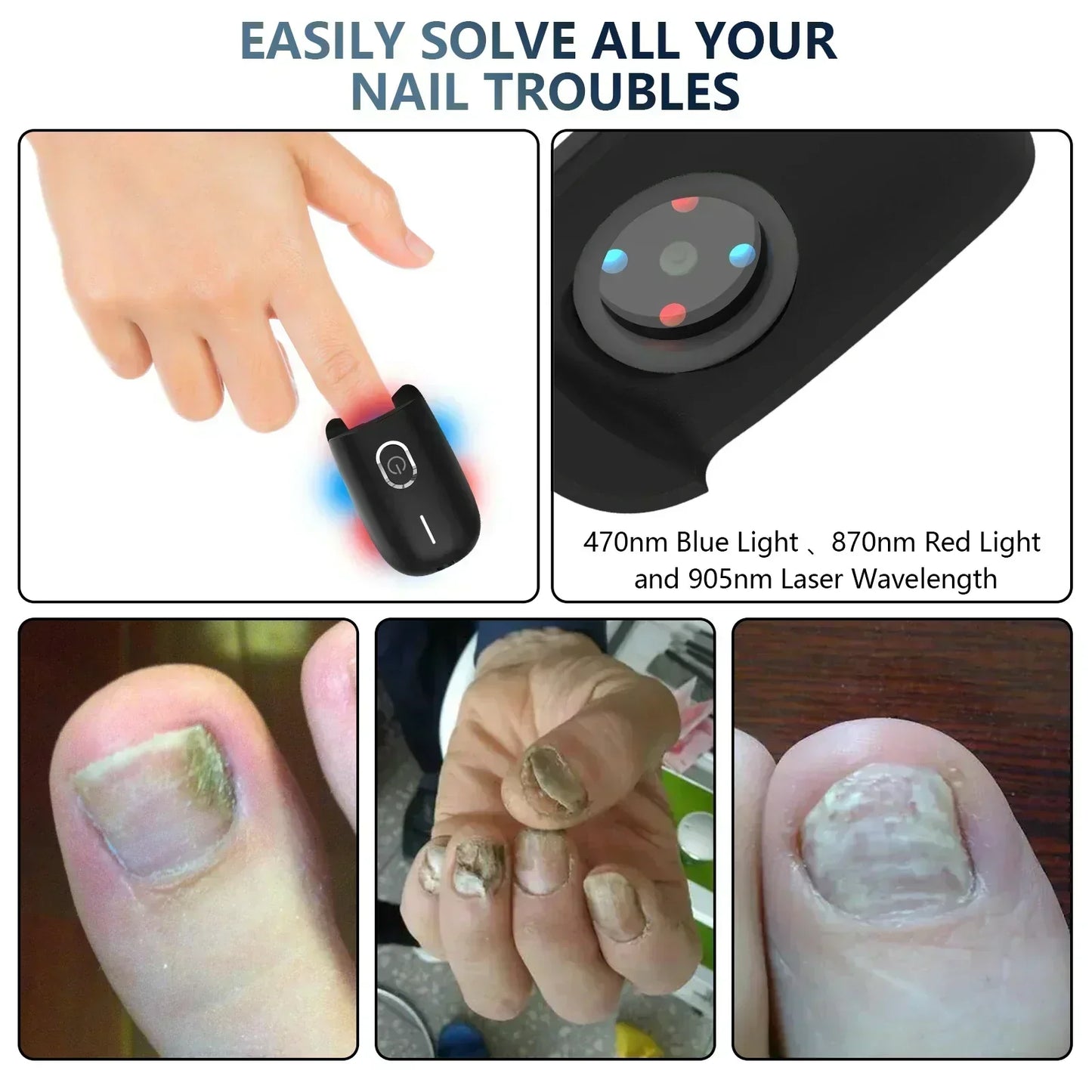 Compact Toenail Fungus Laser Treatment USB Powered Device