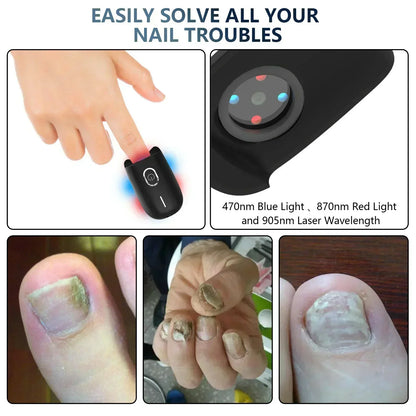 Compact Toenail Fungus Laser Treatment USB Powered Device