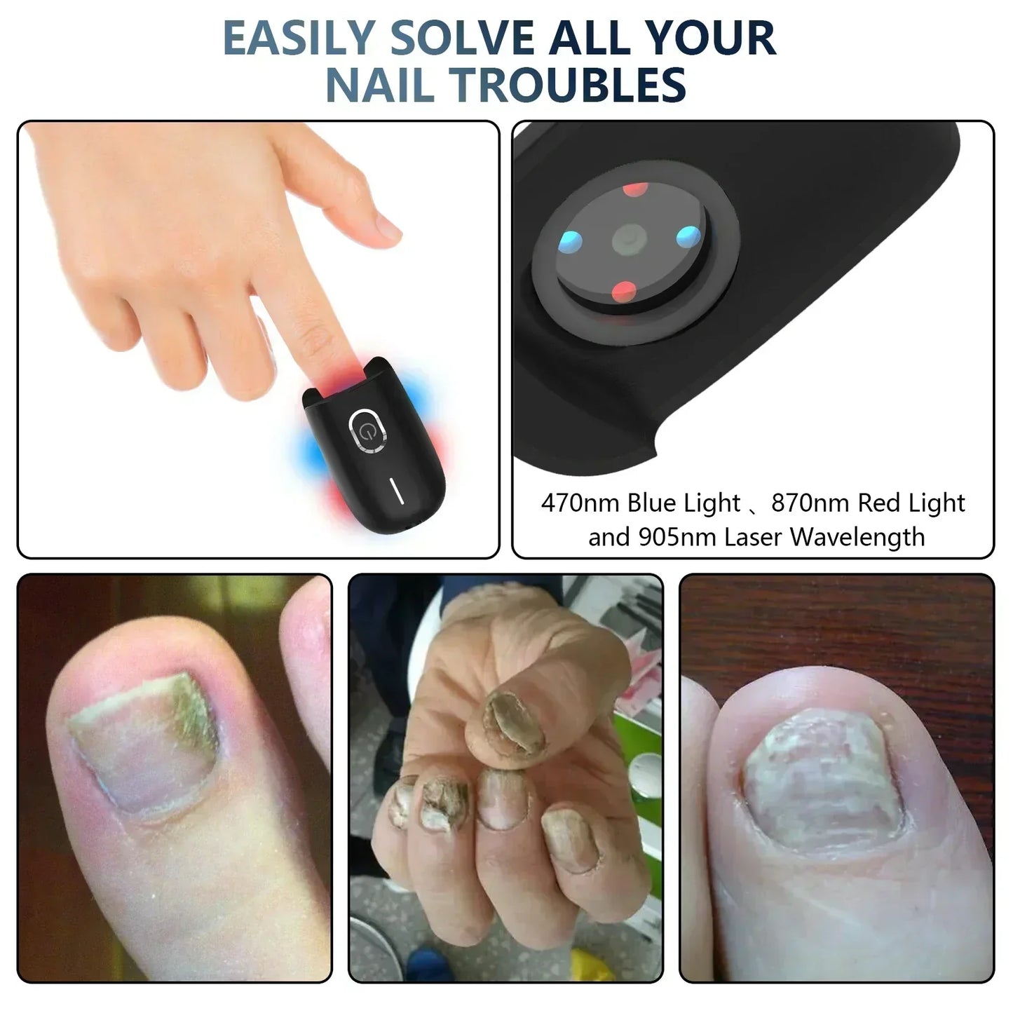 Compact Toenail Laser Treatment with USB Recharge