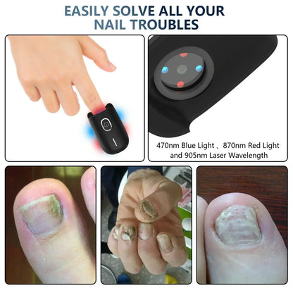 Compact Toenail Laser Treatment with USB Recharge
