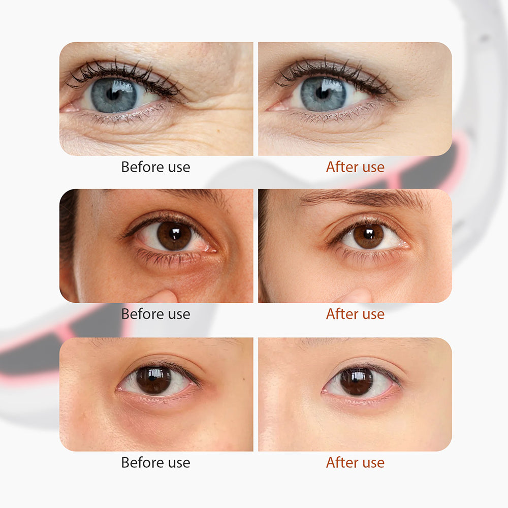 Relaxing Eye Mask for Dark Circles and Wrinkles