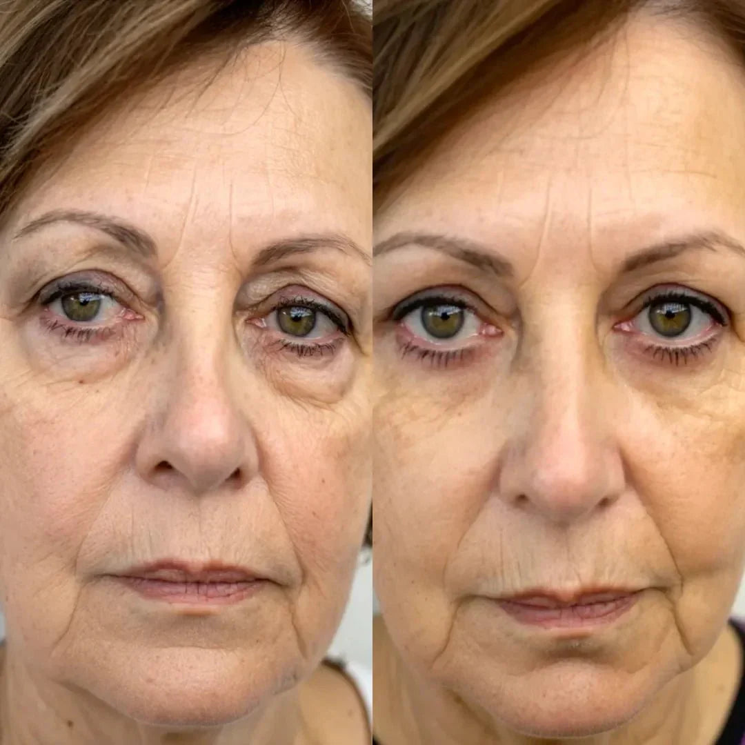 Quick Fix Under Eye Anti Aging Kit