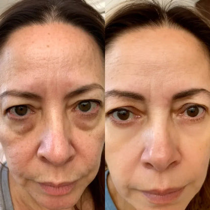 Anti Aging Facial Skin Care Device Red Light Therapy