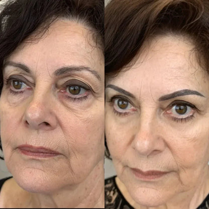 Quick Fix Under Eye Anti Aging Kit