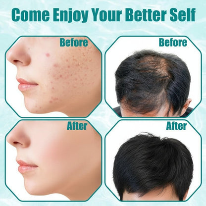 Portable High Frequency Facial Skin Care Tool