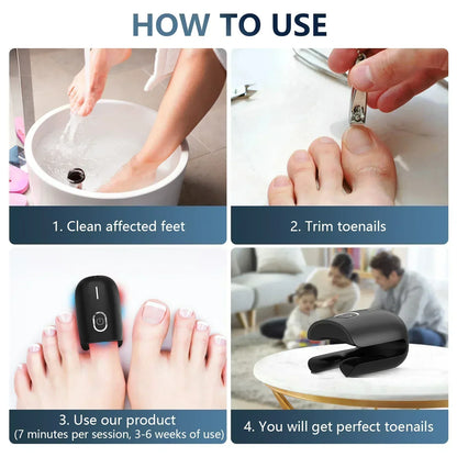 Compact Toenail Laser Treatment with USB Recharge