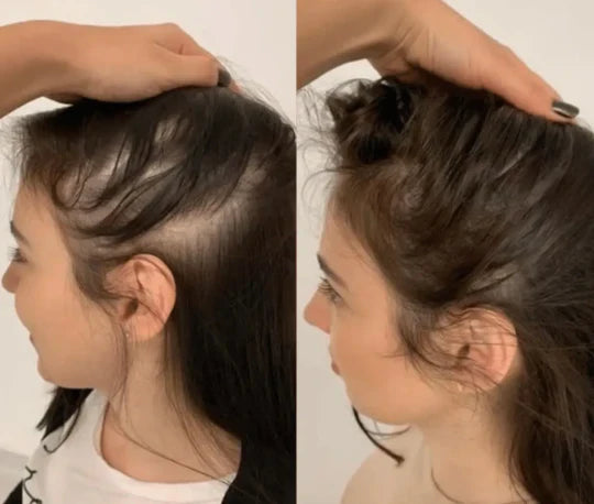 Gentle 3 in 1 Hair Revitalizing Brush and Massager