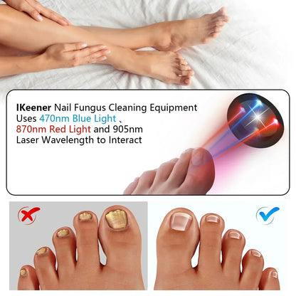 Compact Toenail Laser Treatment with USB Recharge