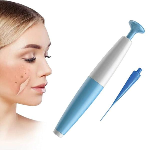 Easy Skin Tag Remover Kit | Fast Effective Removal Tool - Lusomart