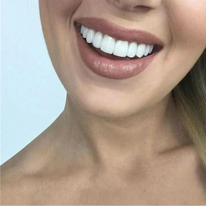 SnapFit | Innovative Customizable Dental Veneers for Perfect Smile 2
