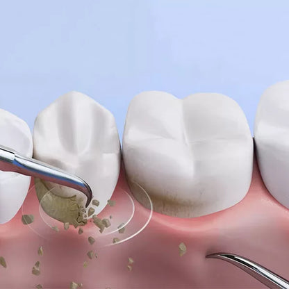 Effective Tartar Remover for Teeth