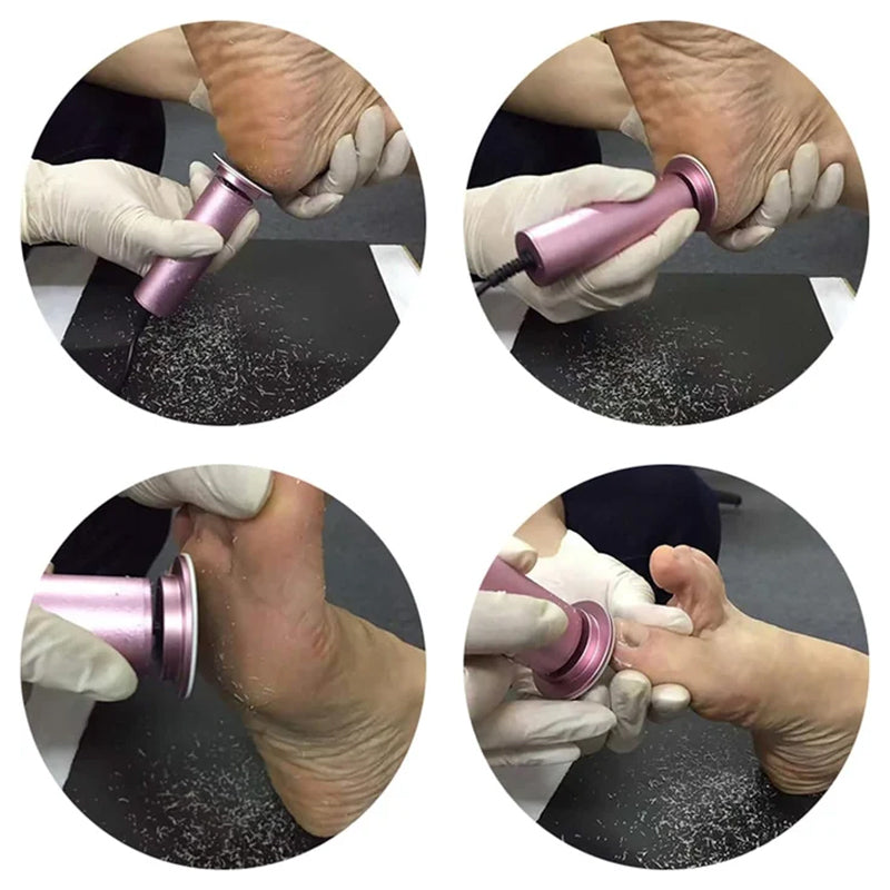 VelvetCare | Elegant Efficient Foot Care Device for Silky Soft Feet 2