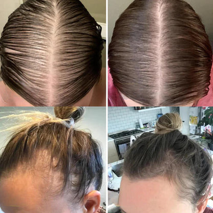 Natural Hair Growth Essential Oil Serum