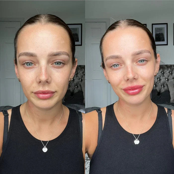 Plumping Lip Serum for Fuller Lips Fast