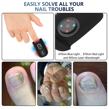 Fast Home Toenail Fungus Removal Laser Device