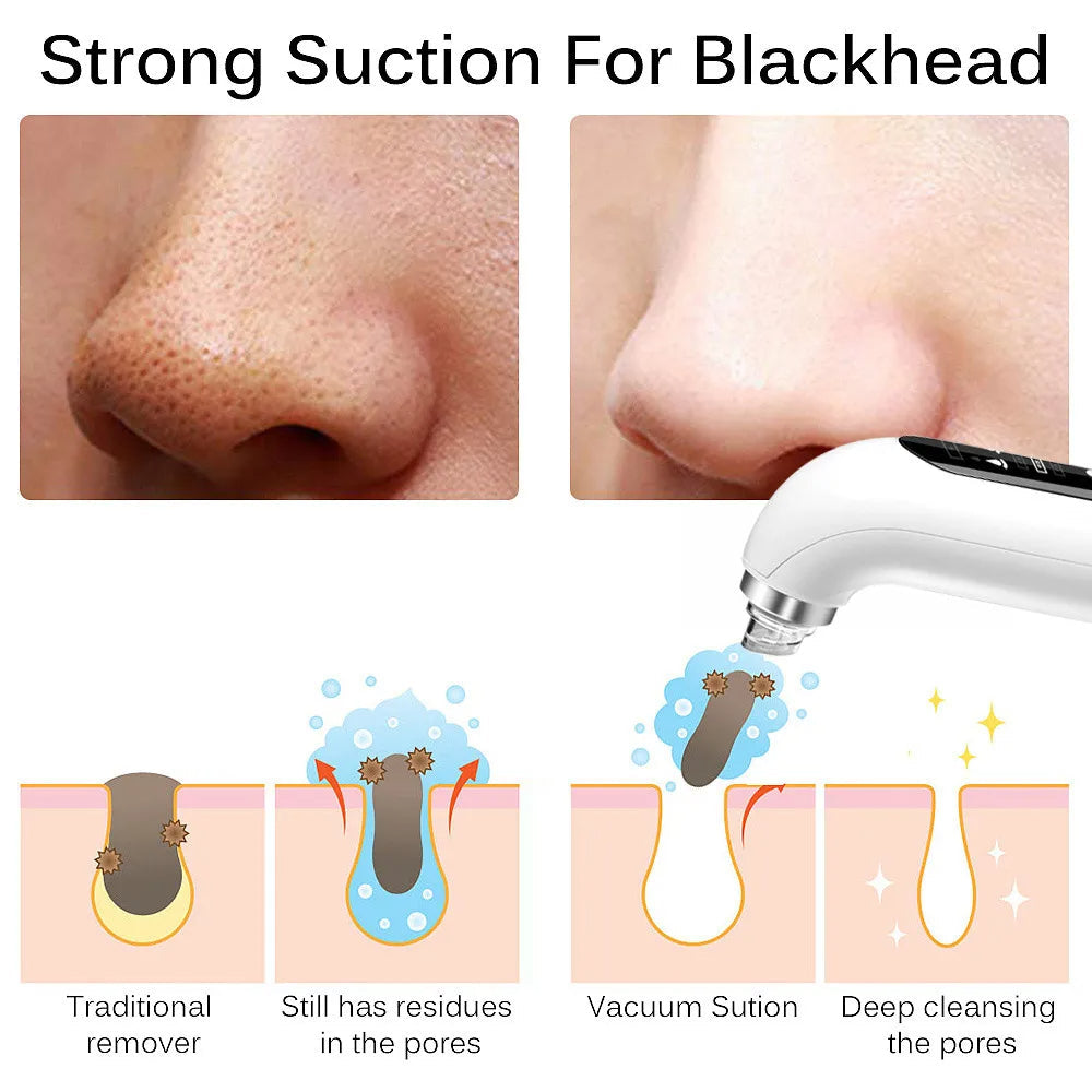Pore Cleansing Blackhead Removal Tool With Soft Suction