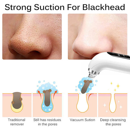 Pore Cleansing Blackhead Removal Tool With Soft Suction