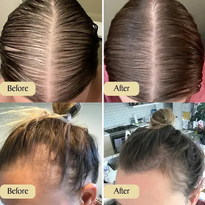 Pure Hair Regrowth Essential Oil