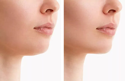Slimming LED Chin Slimmer Neck Wrap