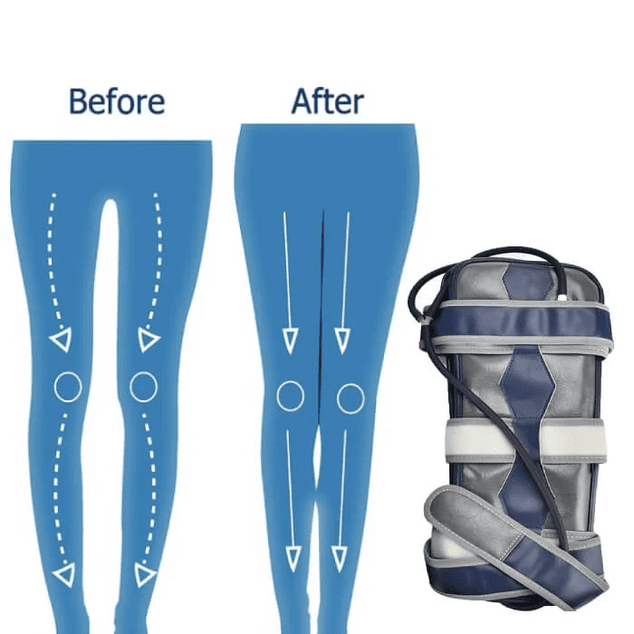 Posture Correcting Back Support Belt With Adjustable Straps