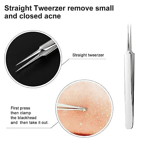 Easy Blackhead Remover Kit, 3 Piece Set