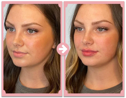 Natural Lip Enhancement Plumping Kit