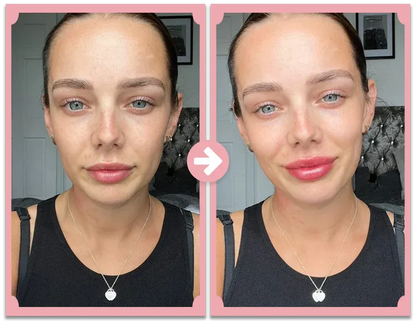 Natural Lip Enhancement Plumping Kit