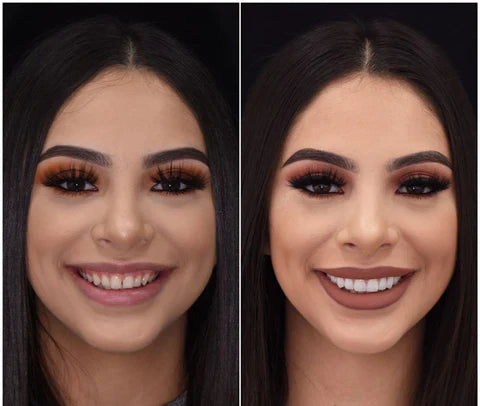 Easy Fit Smile Veneers for Top and Bottom Teeth