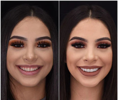 Easy Fit Smile Veneers for Top and Bottom Teeth