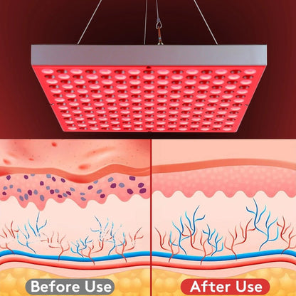 LED Light Therapy Lamp for Sleep and Skin Care
