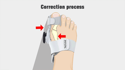 Comfortable Bunion Support for Foot Pain Relief