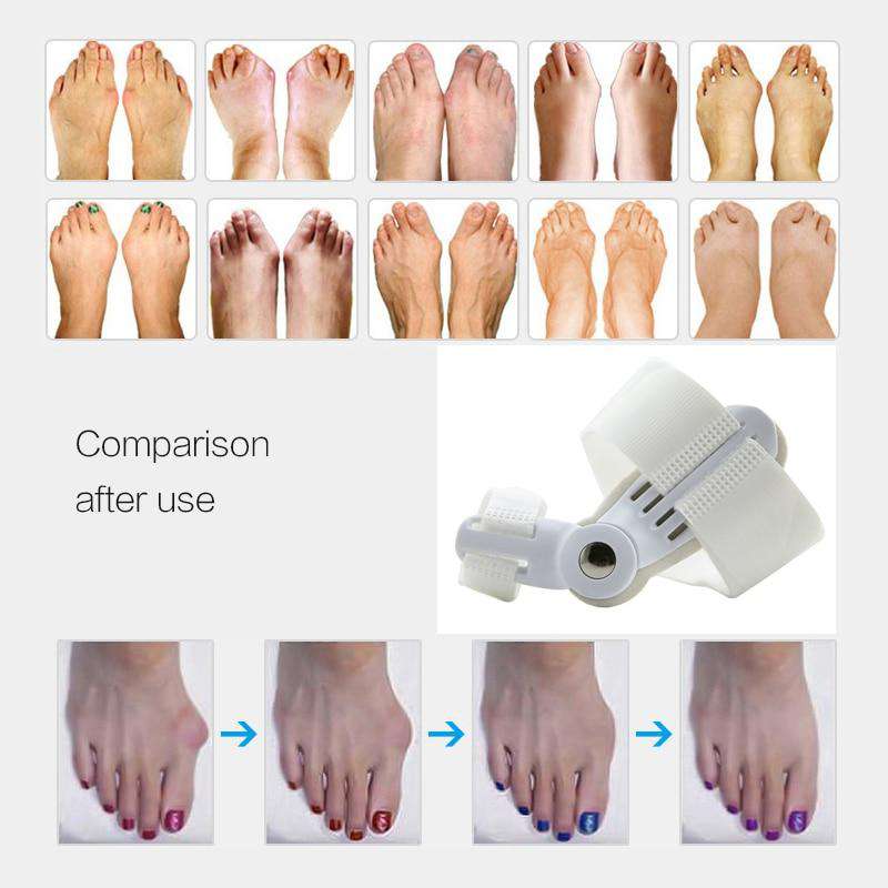 Comfort Bunion Corrector Splint