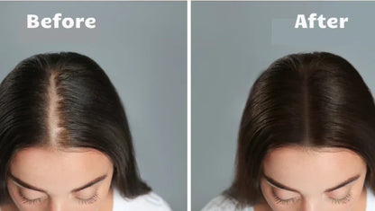 Advanced Hair Growth Therapy Laser System