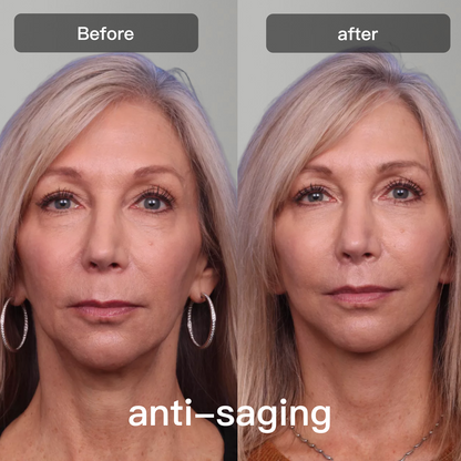 Advanced 7 Color LED Skin Therapy Device